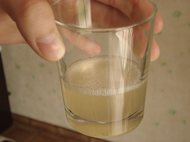 succo di aloe vera