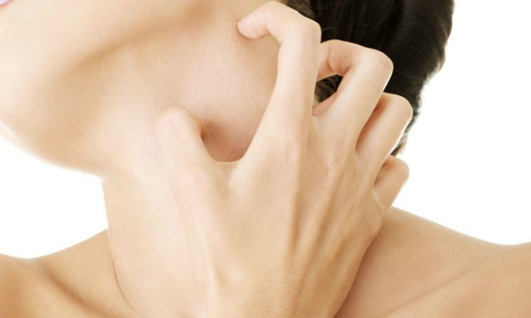 Orticaria acquagenica cos e sintomi e rimedi