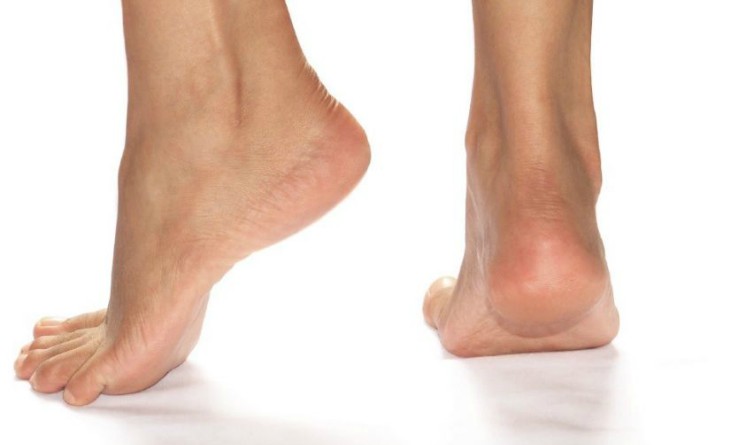 Tiloma plantare cause sintomi e rimedi
